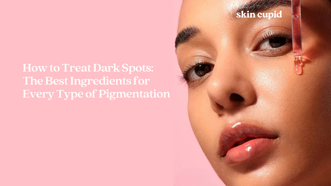 How to Treat Dark Spots: The Best Ingredients for Every Type of Pigmentation