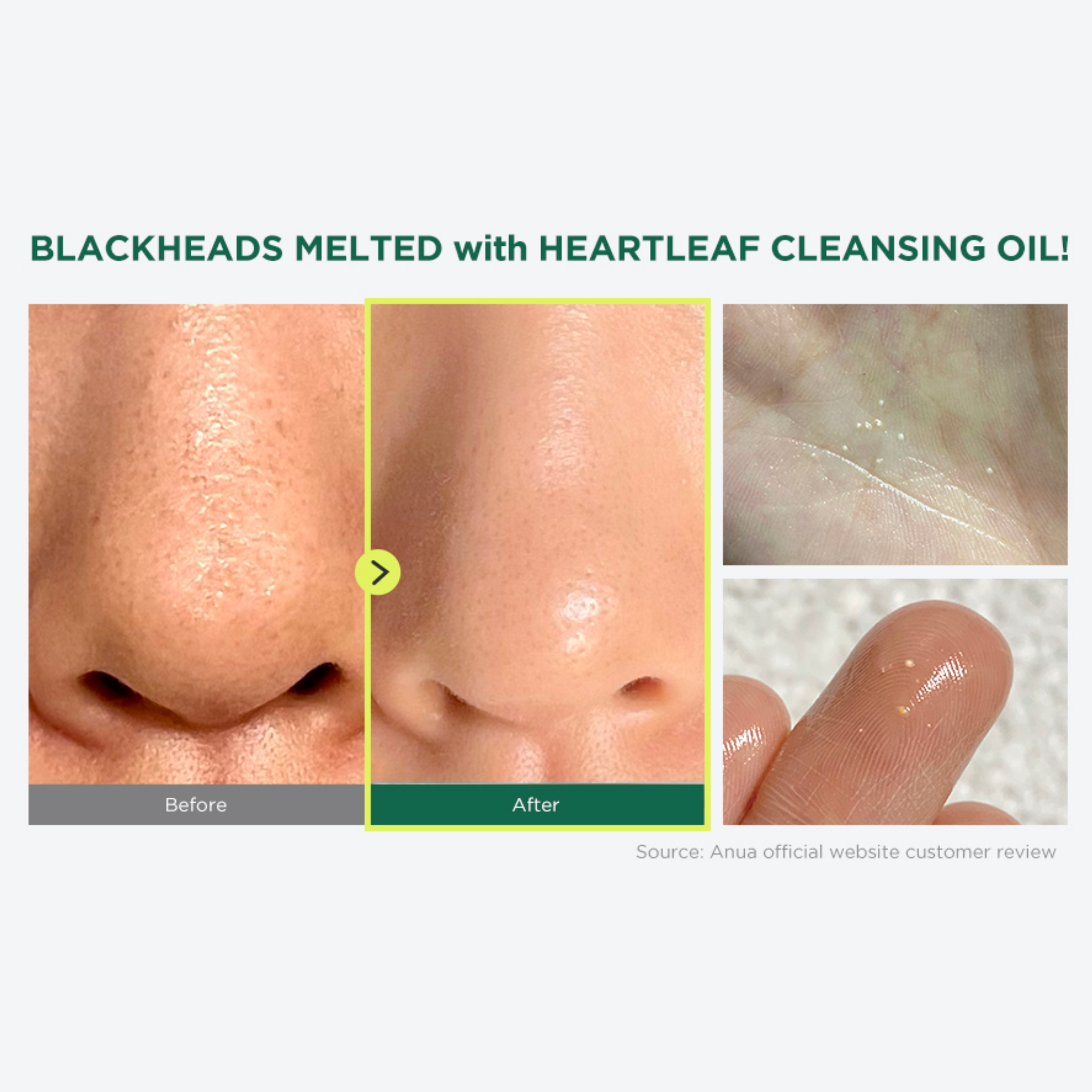 ANUA Heartleaf Pore Control Cleansing Oil (200ml) results