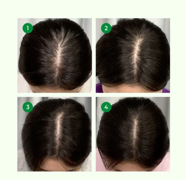 SOME BY MI Hair Cica Peptide Anti Hair Loss Shampoo (285ml) Proven results